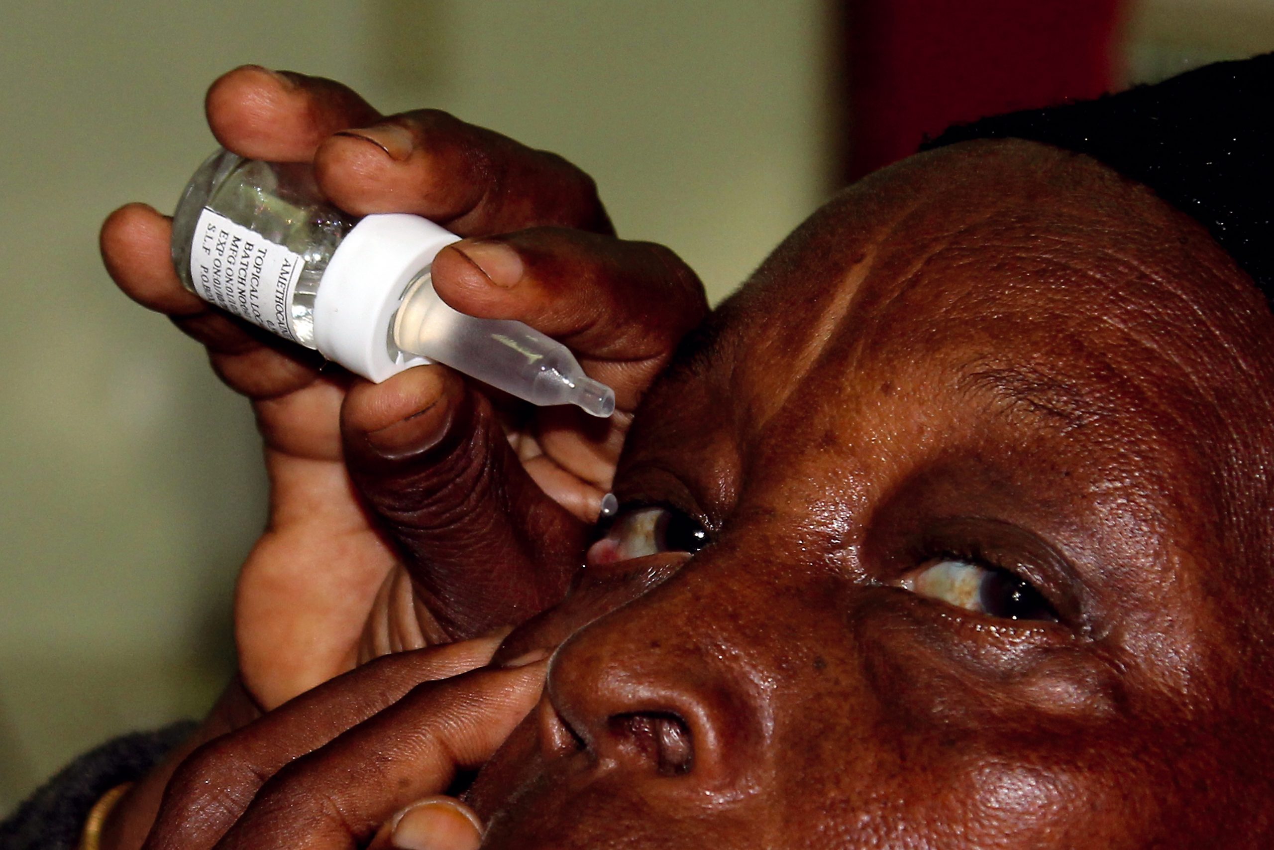 A woman in traditional robes sits on the ground following cataract surgery