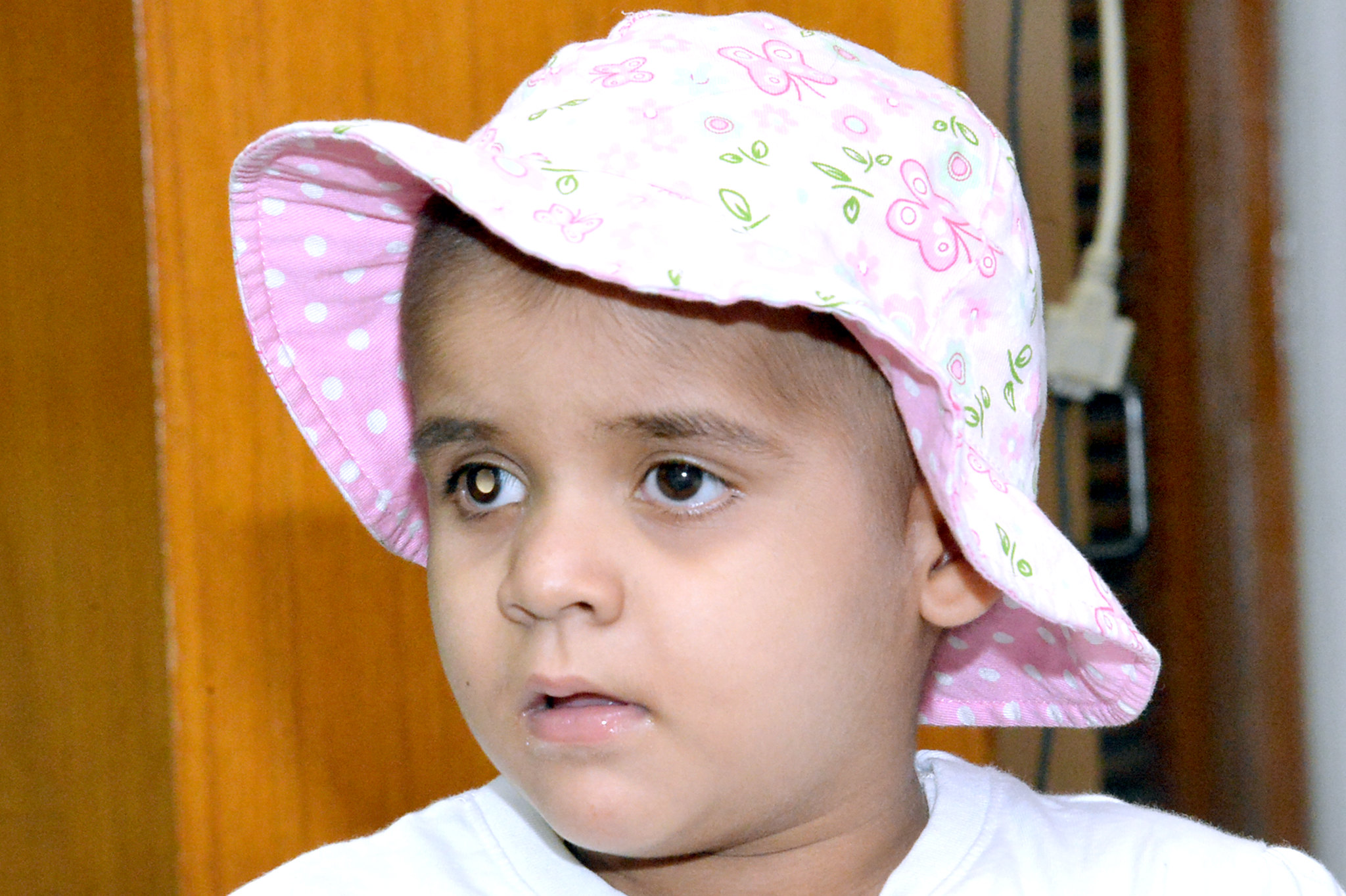 a girl in a pink hat shows the telltale white pupil of retinoblastoma
