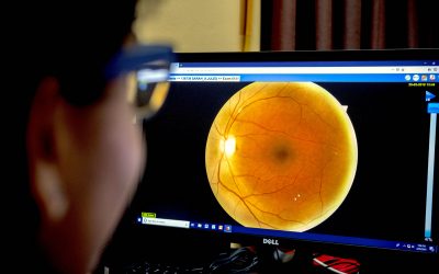 Artificial Intelligence for Diabetic Retinopathy in LMICs: The Research So Far
