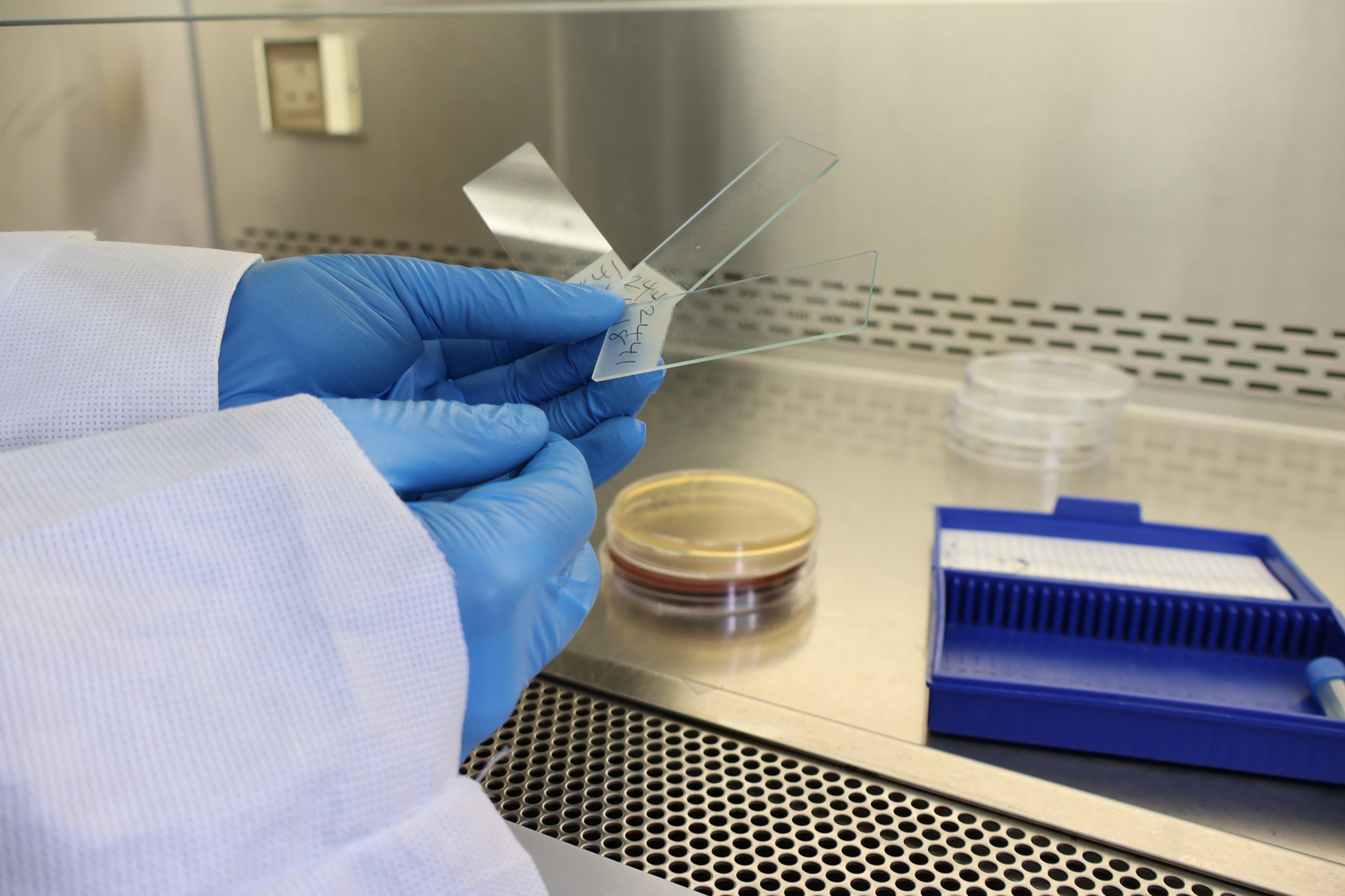 In a lab, two gloved hands hold three microscope slides in front of an isolation chamber