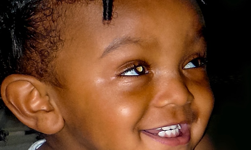 a young child smiles, and shows a white reflection in one eye 