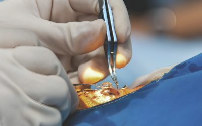 Delivering Effective Cataract Surgical Coverage: Contrasting Lessons from Kenya and Nepal