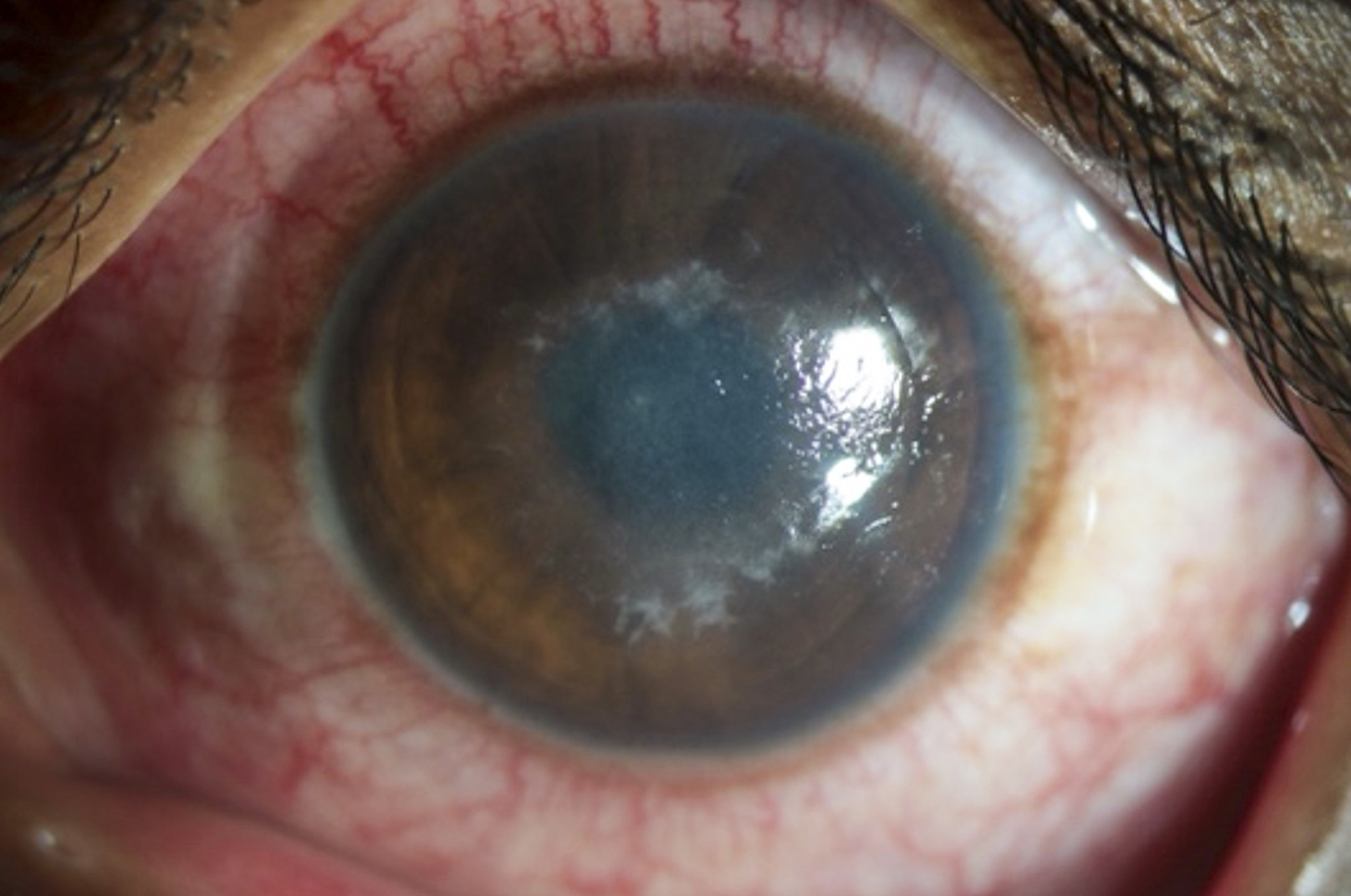54037891933_5962b3bd17_k a close up picture of an eye with a very red sclera and