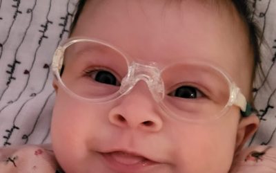 Early near-vision glasses could improve visual development in vulnerable infants, study suggests