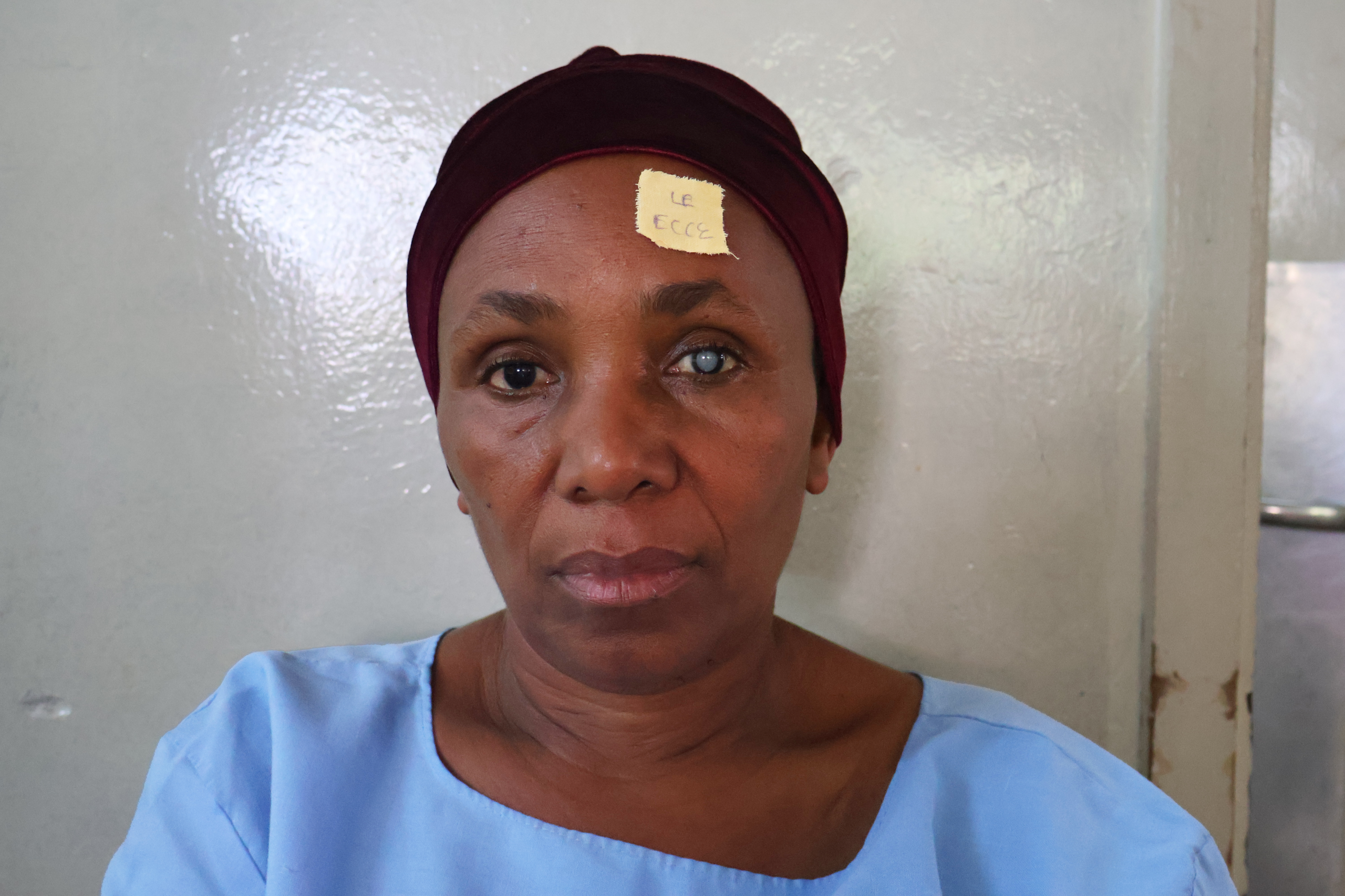 A woman in a headdress and a visible cataract looks at the camera